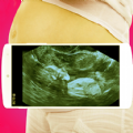 孕妇B超恶搞模拟手机版